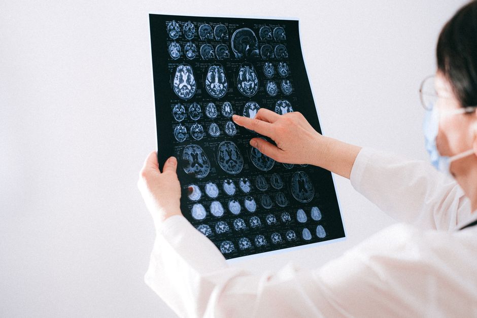 Médico revisando exame de imagem, ilustrando diagnóstico do Alzheimer